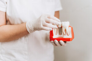 implant banner