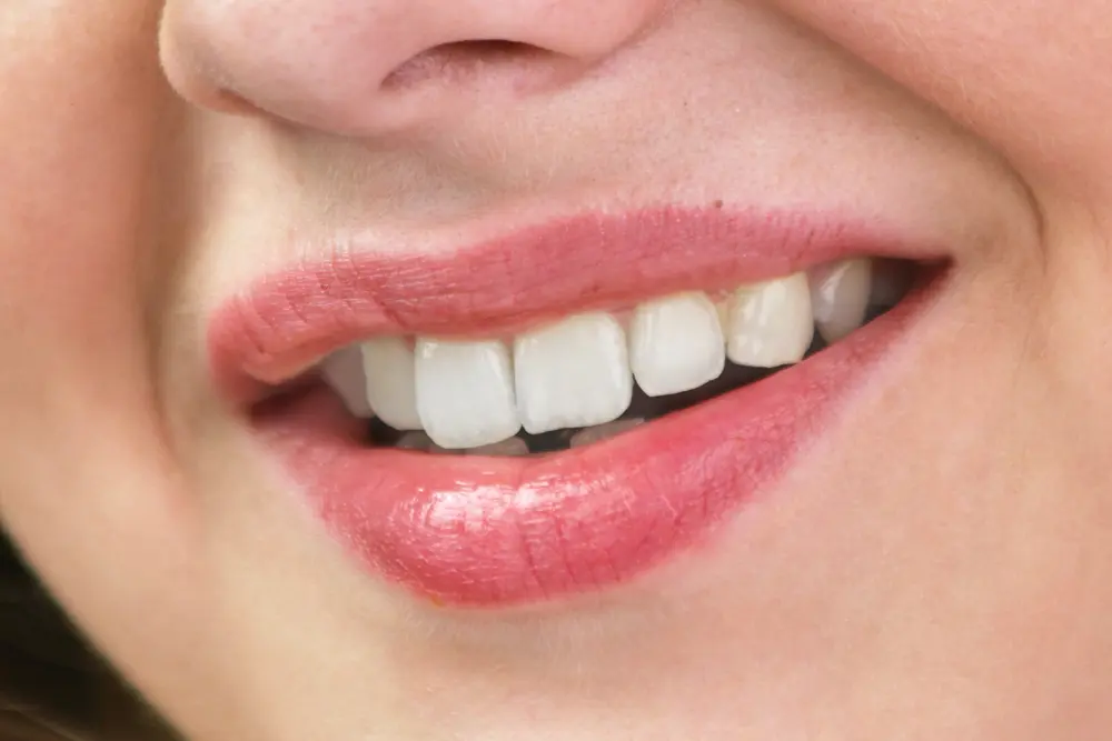 implant img3