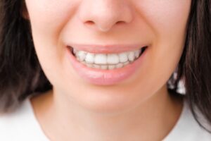 smiling woman with perfect and healthy teeth using 2022 01 28 10 50 08 utc 1