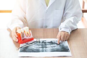 dentist with dental implant model 2021 08 29 01 04 48 utc 1