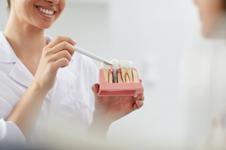 公告訊息 1 smiling dentist explaining tooth implantation 2021 09 24 03 53 51 utc 2 1