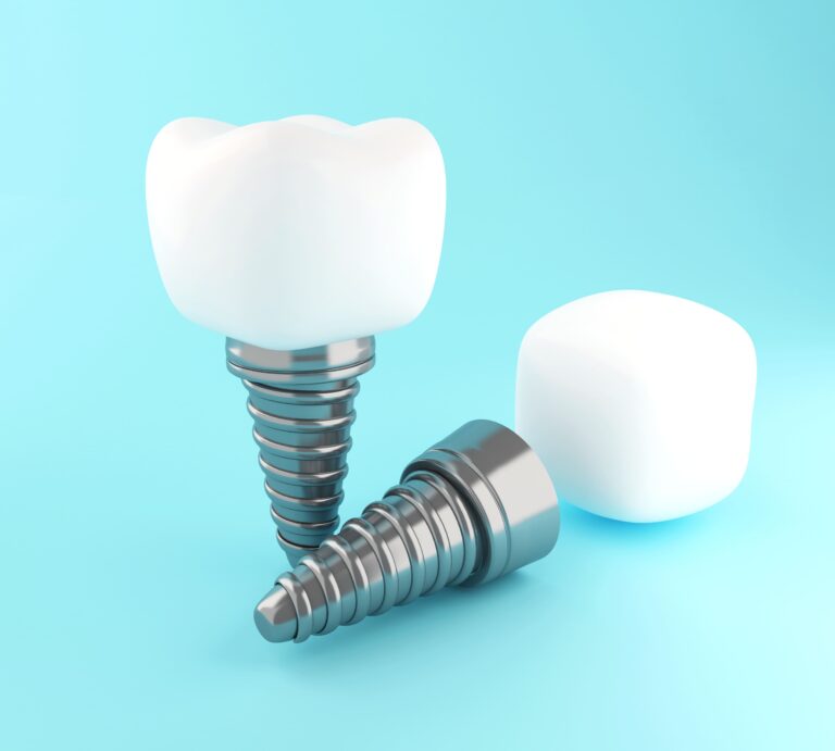 3d dental tooth implant 2021 08 29 10 14 31 utc 1