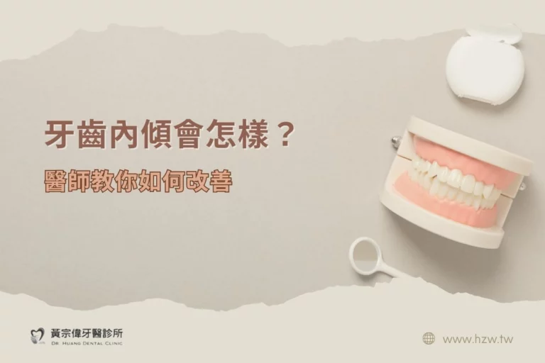 公告訊息 4 牙齒內傾會怎樣?醫師教您如何改善