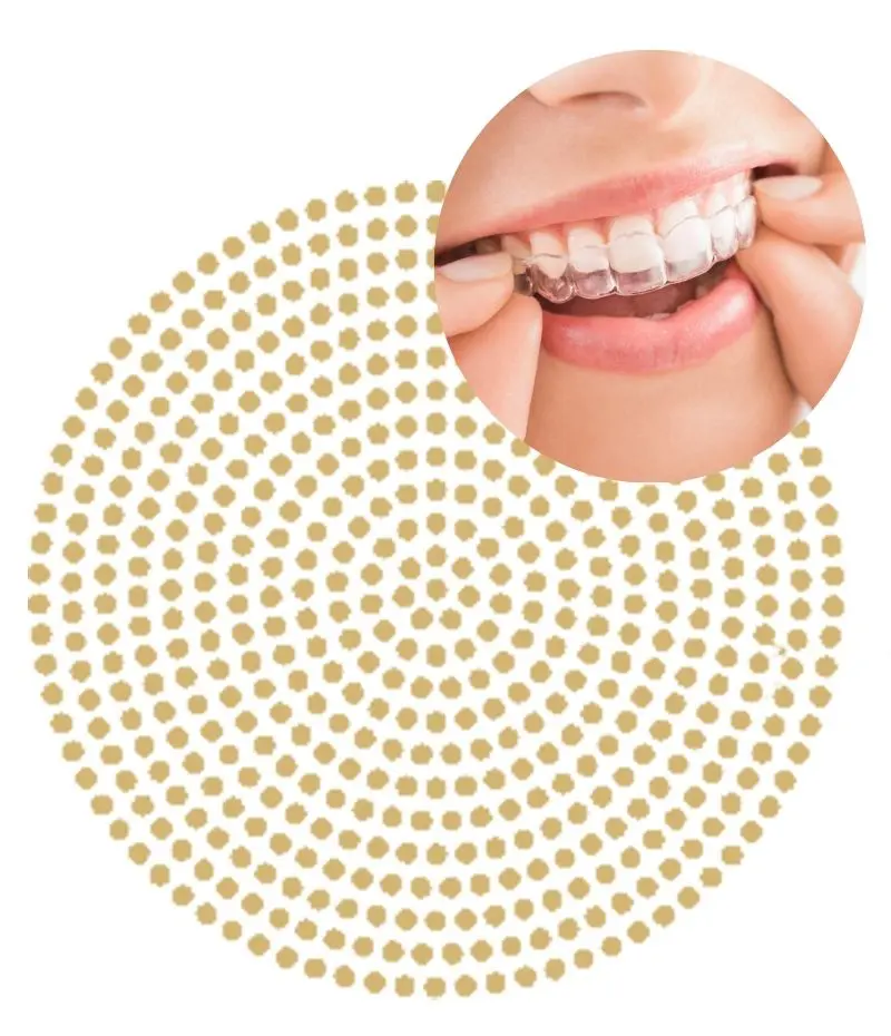 for invisalign page