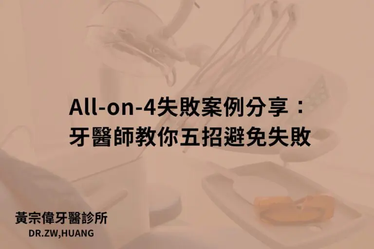 公告訊息 6 All-on-4失敗案例分享:牙醫師教你五招避免失敗