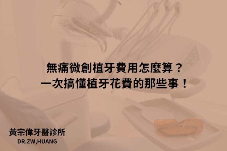 無痛微創植牙費用怎麼算？一次搞懂植牙花費的那些事！