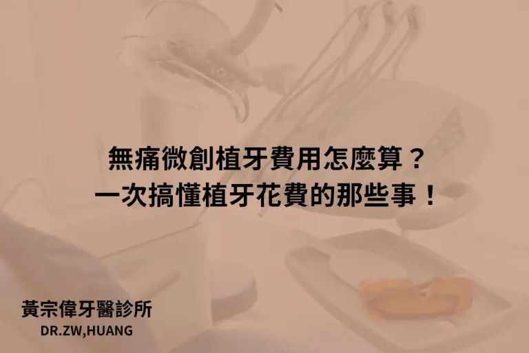 公告訊息 1 無痛微創植牙費用怎麼算?一次搞懂植牙花費的那些事!