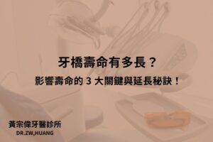 牙橋壽命有多長？影響壽命的 3 大關鍵與延長秘訣！