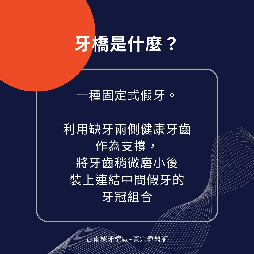 牙橋是什麼