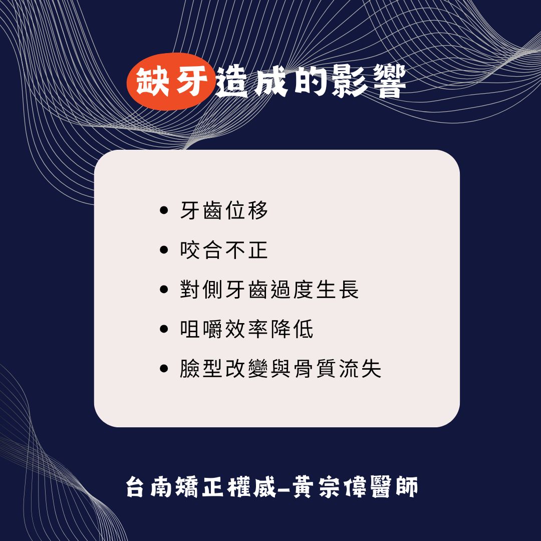 缺牙矯正全面解析,臼齒缺牙怎麼辦?費用、矯正方式全攻略 1 缺牙造成的影響