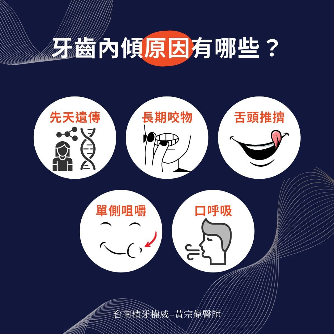 牙齒內傾原因有哪些
